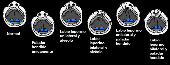 https://boxedfromabove.store/SiteCollectionImagesArticleImages/CleftlippalateABCDEF_es.jpg